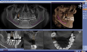 picture of a x-ray